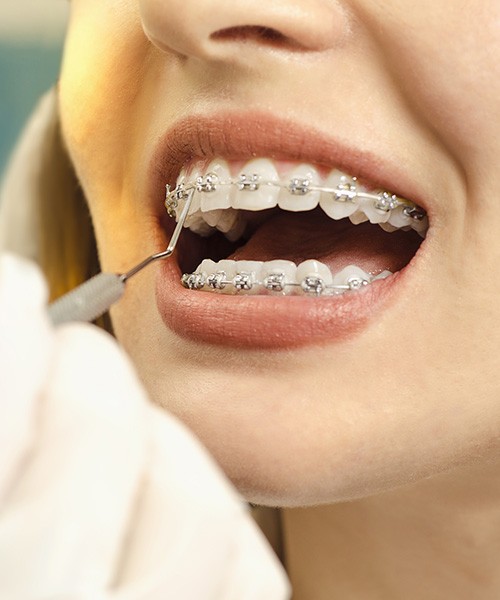 Clínica Dentária Morgado - Ortodontia